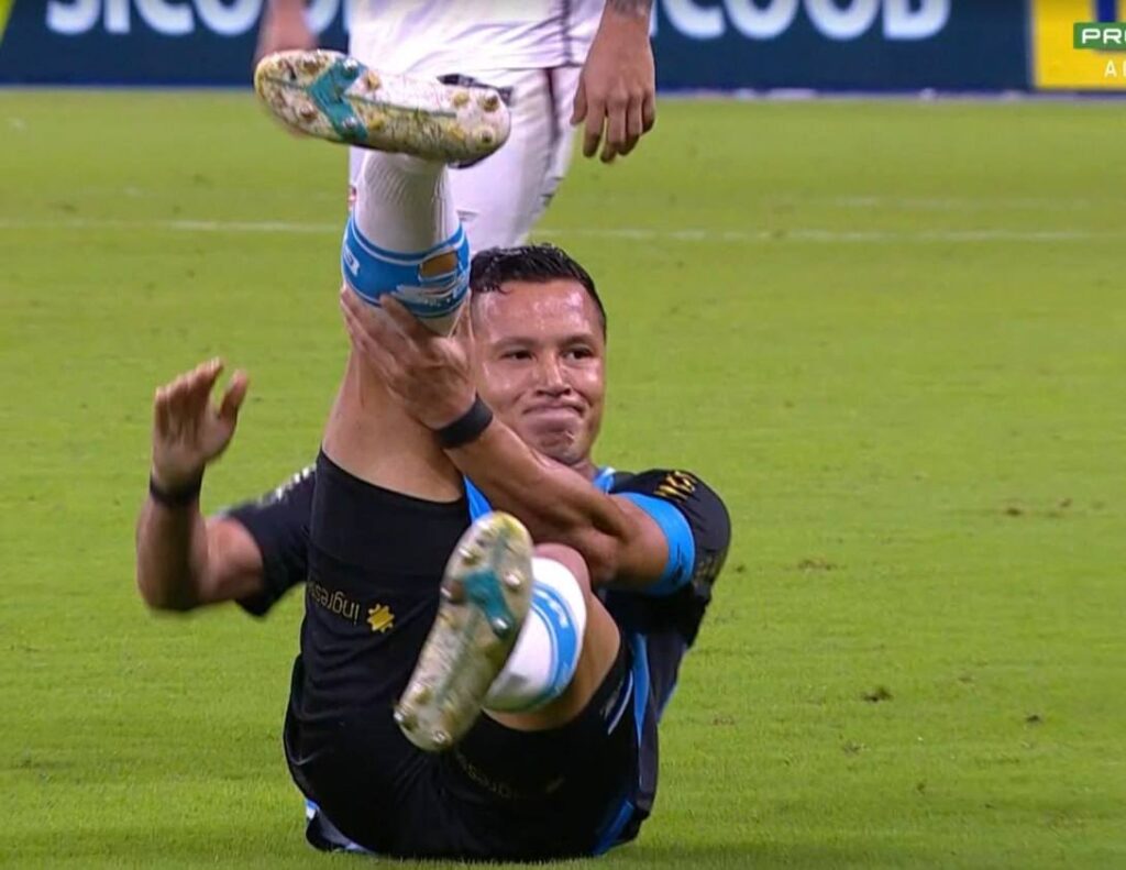 Lesión de Marlon, Gremio